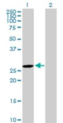 Western Blot: DUSP27/DUPD1 Antibody [H00338599-B01P] - Analysis of DUPD1 expression in transfected 293T cell line by DUPD1 polyclonal antibody.  Lane 1: DUPD1 transfected lysate(24.2 KDa). Lane 2: Non-transfected lysate.