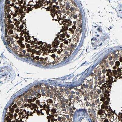 Immunohistochemistry-Paraffin: DUSP27 dual specificity phosphatase 27 Antibody [NBP1-86472] - Staining of human testis shows strong nuclear and cytoplasmic positivity in cells in seminiferus ducts.