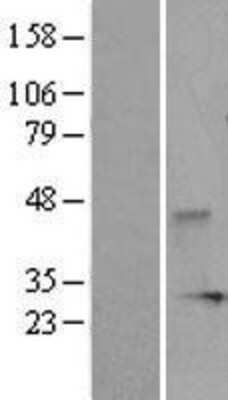 Western Blot: DUSP3 Overexpression Lysate (Adult Normal) [NBL1-10053] Left-Empty vector transfected control cell lysate (HEK293 cell lysate); Right -Over-expression Lysate for DUSP3.