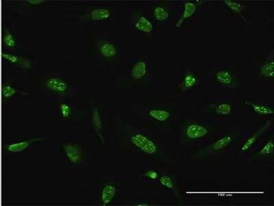 Immunocytochemistry/Immunofluorescence: DUSP4 Antibody [H00001846-D01P] - Analysis of antibody to DUSP4 on HeLa cell. Antibody concentration 10 ug/ml.