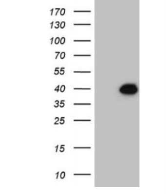 Western Blot: DUSP4 Antibody (OTI7C11) - Azide and BSA Free [NBP2-70610] - HEK293T cells were transfected with the pCMV6-ENTRY control (Left lane) or pCMV6-ENTRY DUSP4 ( Right lane) cDNA for 48 hrs and lysed. Equivalent amounts of cell lysates (5 ug per lane) were separated by SDS-PAGE and immunoblotted with antiDUSP4.(1:2000)