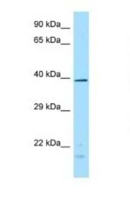 Western Blot: DUSP4 Antibody [NBP1-98449] - Titration: 1.0 ug/ml Positive Control: Fetal Brain.