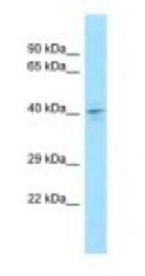 Western Blot: DUSP4 Antibody [NBP1-98499] - COLO205 Cell Lysate 1.0ug/ml, Gel Concentration: 12%