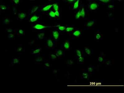 Immunocytochemistry/Immunofluorescence: DUSP5 Antibody (4C8) [H00001847-M03] - Analysis of monoclonal antibody to DUSP5 on HeLa cell. Antibody concentration 10 ug/ml