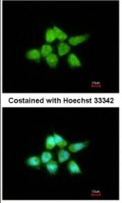 Immunocytochemistry/Immunofluorescence: DUSP8 Antibody [NBP1-31169] - Paraformaldehyde-fixed A431, using antibody at 1:200 dilution.
