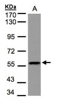 Western Blot: DUSP8 Antibody [NBP1-31169] - Sample(30 ug of whole cell lysate)A:Raji 7.5% SDS PAGE, antibody diluted at 1:1000.