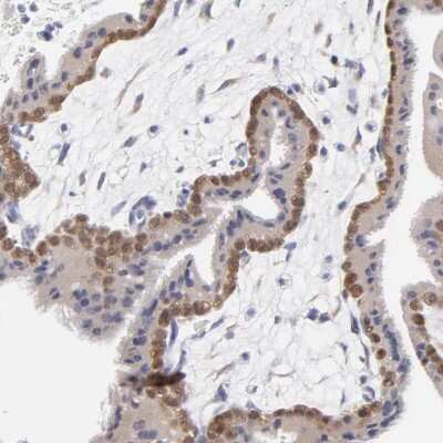 <b>Orthogonal Strategies Validation. </b>Immunohistochemistry-Paraffin: DUSP9 Antibody [NBP1-82641] - Staining of human placenta shows high expression.