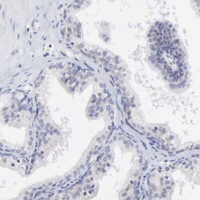 Immunohistochemistry-Paraffin: DUSP9 Antibody [NBP1-82641] - Staining of human prostate shows low expression as expected.
