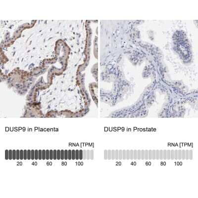Immunohistochemistry-Paraffin: DUSP9 Antibody [NBP1-82641] - Staining in human placenta and prostate tissues using anti-DUSP9 antibody. Corresponding DUSP9 RNA-seq data are presented for the same tissues.