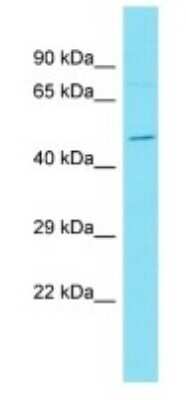 Western Blot: DUX1 Antibody [NBP3-09704] - Western blot analysis of DUX1 in Human ACHN Whole Cell. Antibody dilution at 1ug/ml