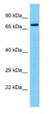 Western Blot: DUX1 Antibody [NBP3-09917] - Western blot analysis of DUX1 in Human HCT15 Whole Cell . Antibody dilution at 1ug/ml