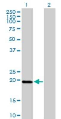 Western Blot: DUX3 Antibody (3D2) [H00026582-M01] - Analysis of DUX3 expression in transfected 293T cell line by DUX3 monoclonal antibody (M01), clone 3D2.Lane 1: DUX3 transfected lysate(19.4 KDa).Lane 2: Non-transfected lysate.