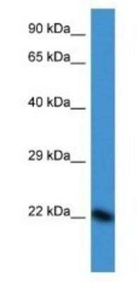 Western Blot: DUX3 Antibody [NBP1-82394] - HepG2 Cell Lysate 1ug/ml Gel Concentration 12%