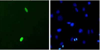 Immunocytochemistry/Immunofluorescence: DUX4 Antibody (P2B1) [NBP2-12886] - Tissue: C2C12 myoblast cells. Species: Mouse. Primary Antibody: Mouse Anti-DUX4 Monoclonal Antibody at 1:1000. Secondary Antibody: FITC Goat Anti-Mouse (green). Counterstain: DAPI (blue) nuclear stain.