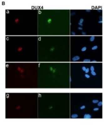 Immunocytochemistry/Immunofluorescence: DUX4 Antibody (P4H2) - Azide and BSA Free [NBP2-80703] - A small number of FSHD muscle cells express a relatively large amount of DUX4. Cultured FSHD muscle cells were differentiated and immunostained with mAbs to DUX4. Cells were co-stained with the E5-5 rabbit mAb to the DUX4 C-terminal region (panels a, c, e) and the P2G4 mouse mAb to the N-term. region (panels b,d,f), or co-stained with the P4H2 mouse mAb to the C-terminal region and the E14-3 rabbit mAb to the N-term. region. Approximately 1 cell per 1000 showed nuclear staining and the co-localization of both the N-term. and C-term. regions indicates that these cells are expressing the full-length DUX4 protein. No positive nuclei were apparent in the control muscle cultures. Image collected and cropped by CiteAb from the following publication (//dx.plos.org/10.1371/journal.pgen.1001181), licensed under a CC-BY license. Image from the standard format of this antibody.