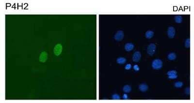 Immunocytochemistry/Immunofluorescence: DUX4 Antibody (P4H2) - Azide and BSA Free [NBP2-80703] - Detection of human DUX4 on C2C12 mouse myoblasts transfected with pCS2-DUX4. Cells were counterstained with DAPI for nuclei. Image from the standard format of this antibody.