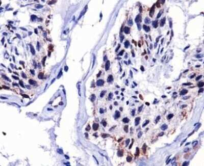 Immunohistochemistry: DUX4 Antibody (P4H2) - Azide and BSA Free [NBP2-80703] - Analysis of DUX4 on human testis Image from the standard format of this antibody.