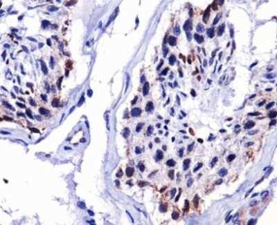 Immunohistochemistry: DUX4 Antibody (P4H2) [NBP1-49552] - Analysis of DUX4 on human testis