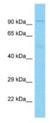 Western Blot: DUX4 Antibody [NBP3-10390] - Western blot analysis of DUX4 in Ovary tumor lysates. Antibody dilution at 1.0ug/ml