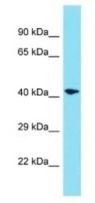 Western Blot: DUX4L2 Antibody [NBP3-09705] - Western blot analysis of DUX4L2 in Human HT1080 Whole Cell. Antibody dilution at 1ug/ml