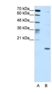 Western Blot: DUX5 Antibody [NBP1-80322] - Titration: 5.0ug/ml, Positive Control: HepG2 cell lysate.