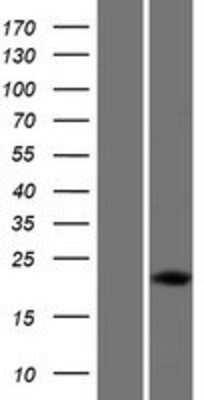 Western Blot: DUX5 Overexpression Lysate (Adult Normal) [NBP2-07484] Left-Empty vector transfected control cell lysate (HEK293 cell lysate); Right -Over-expression Lysate for DUX5.