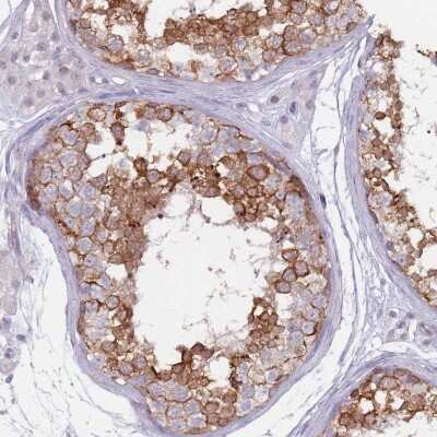 Immunohistochemistry: DXO Antibody [NBP2-47478] - Staining of human testis shows strong cytoplasmic positivity in cells in seminiferus ducts.