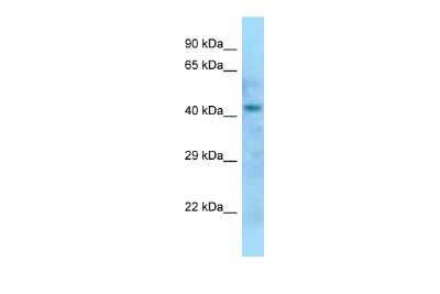 Western Blot: DXO Antibody [NBP2-87313] - WB Suggested Anti-Dom3z Antibody. Titration: 1.0 ug/ml. Positive Control: Rat Liver