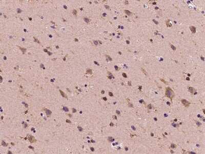Immunohistochemistry-Paraffin: DYDC1 Antibody [NBP2-97558] - Immunochemical staining of human DYDC1 in human brain with rabbit polyclonal antibody at 1:100 dilution, formalin-fixed paraffin embedded sections.