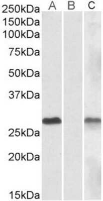 Western Blot: DYDC1 Antibody [NBP1-47218] - Lane A - NBP1-47218 (1ug/ml) staining of HEK293 overexpressing Human DYDC1 lysate (10ug protein in RIPA buffer) Lane B - NBP1-47218 (1ug/ml) staining of HEK293 mock-transfected lysate (10ug protein in RIPA buffer). Lane C - EB00106 anti-MYC Tag (1/1000) staining HEK293 overexpressing Human DYDC1 lysate (10ug protein in RIPA buffer). Primary incubations were for 1 hour. Detected by chemiluminescence.