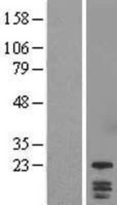 Western Blot: DYDC1 Overexpression Lysate (Adult Normal) [NBL1-10065] Left-Empty vector transfected control cell lysate (HEK293 cell lysate); Right -Over-expression Lysate for DYDC1.