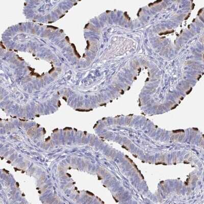 Immunohistochemistry-Paraffin: DYDC2 Antibody [NBP2-38377] - Staining of human fallopian tube shows high expression.