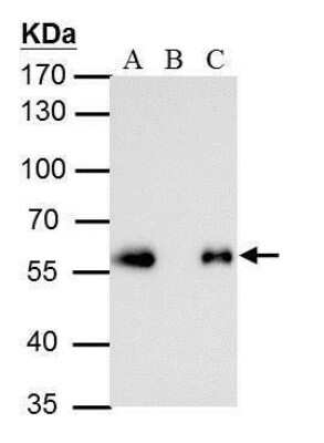 Immunoprecipitation: DYKDDDDK Epitope Tag Antibody (231) [NBP2-43570] - Analysis of 750 ug whole cell lysate/extract of DDDK-tagged protein expressing 293T cells. A : 5 ug whole cell lysate/extract of DDDDK-tagged protein expressing 293T cells B : Control with 2.5 ug of pre-immune mouse IgG C : Immunoprecipitation of DDDK-tagged protein by 2.5 ug of DYKDDDDK Epitope Tag Antibody (231) [NBP2-43570] 7.5% SDS-PAGE The immunoprecipitated DDDK-tagged protein was detected by DYKDDDDK Epitope Tag Antibody (231) diluted at 1 : 5000. EasyBlot anti-mouse IgG was used as a secondary reagent.