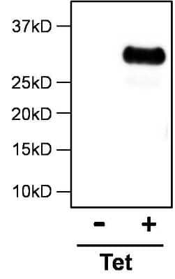 <b>Biological Strategies Validation. </b>Immunoprecipitation: DYKDDDDK Epitope Tag Antibody (FG4R) [NBP2-37823] - Analysis of Chlamydia trachomatis FLAG-tagged IncA in HeLa cells infected with a strain of Chlamydia trachomatis expressing FLAG-IncA under control of a Tetracycline (Tet) promoter, untreated (-) or treated with anhydrotetracycline (+). Complexes formed by incubating 1ml of HeLa cell lysate with 3ug of  [NBP2-37823] overnight at 4C. Immune complexes were captured on 20ul Protein G agarose and eluted by boiling in Laemmli sample buffer. Samples were resolved on a 10% Bis-Tris acrylamide gel, transferred to a PVDF membrane, and blocked with 5% milk in TBST for 1 hr at RT. Membrane was probed with a rabbit anti-FLAG pAb at 1:200 in 3% BSA in TBST overnight at 4C, washed in TBST, and incubated with an HRP-conjugated donkey anti-rabbit IgG secondary Ab at 1:15000 in 1% milk in TBST for 1 hr at RT. Chemiluminescence performed using SuperSignal West Dura. Data courtesy of Innovators Program.