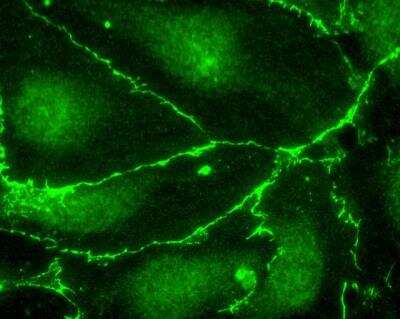 Immunocytochemistry/Immunofluorescence: DYKDDDDK Epitope Tag Antibody [NB600-345] - Samples: Human microvascular endothelial cells expressing FLAG tagged beta-catenin following transient transfection. Antibody: Affinity purified goat DYKDDDDK Epitope Tag Antibody [NB600-345] used at 1 ug/ml. Detection: FITC labeled rabbit anti-goat IgG (h+l).