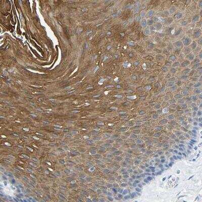 Immunohistochemistry: DYNAP Antibody [NBP1-93793] - Staining of human esophagus shows strong cytoplasmic positivity in squamous epithelial cells.