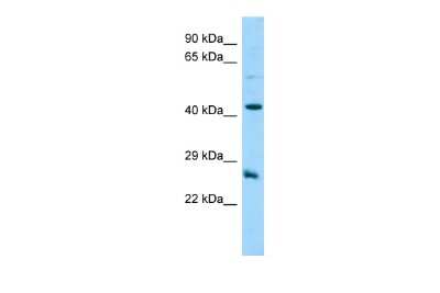 Western Blot: DYNAP Antibody [NBP2-82937] - Host: Rabbit. Target Name: C18orf26. Sample Type: MCF7 Whole Cell lysates. Antibody Dilution: 1.0ug/ml