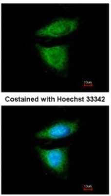 Immunocytochemistry/Immunofluorescence: DYNC1I2 Antibody [NBP1-31703] - Analysis of methanol-fixed HeLa, using antibody at 1:200 dilution.