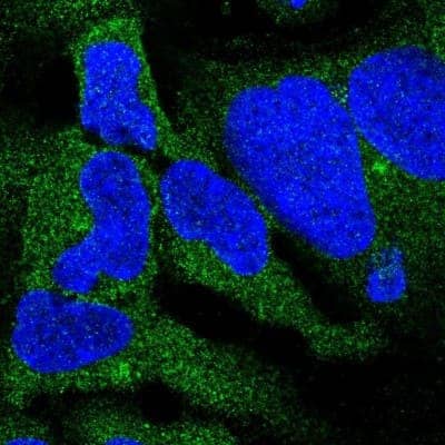 Immunocytochemistry/Immunofluorescence: DYNC1I2 Antibody [NBP2-38469] - Staining  of human cell line HEK 293 shows positivity in cytoplasm and aggresome. Antibody staining is shown in green.