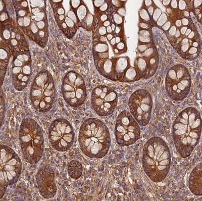Immunohistochemistry-Paraffin: DYNC1I2 Antibody [NBP2-38469] - Staining of human small intestine shows strong cytoplasmic positivity in glandular cells.