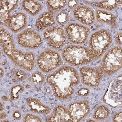 Immunohistochemistry-Paraffin: DYNC1I2 Antibody [NBP2-38714] - Staining of human kidney shows strong cytoplasmic and membranous positivity in cells in tubules.