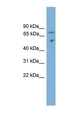 Western Blot: DYNC1I2 Antibody [NBP1-56998] - Jurkat cell lysate, concentration 0.2-1 ug/ml.