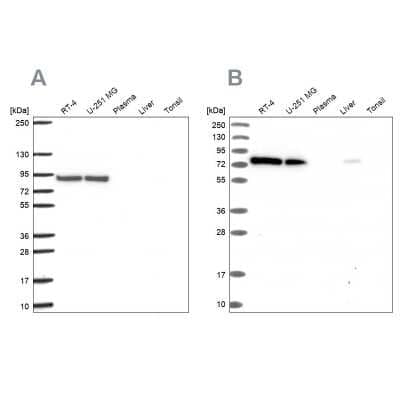 Western Blot: DYNC1I2 Antibody [NBP2-38714] - Analysis using Anti-DYNC1I2 antibody NBP2-38714 (A) shows similar pattern to independent antibody NBP2-38469 (B).