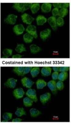 Immunocytochemistry/ Immunofluorescence DYNC1LI1 Antibody - BSA Free