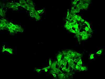 Immunocytochemistry/Immunofluorescence: DYNC1LI1 Antibody [NBP2-97545] - Immunofluorescence staining of DYNC1LI1 in A431 cells. Cells were fixed with 4% PFA, permeabilzed with 0.1% Triton X-100 in PBS, blocked with 10% serum, and incubated with rabbit anti-Human DYNC1LI1 polyclonal antibody (dilution ratio 1:200) at 4C overnight. Then cells were stained with the Alexa Fluor(R)488-conjugated Goat Anti-rabbit IgG Secondary antibody (green). Positive staining was localized to Cytoplasm.