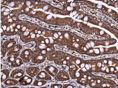 Immunohistochemistry-Paraffin DYNC1LI1 Antibody - BSA Free