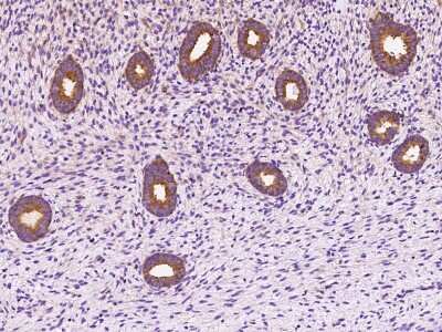 Immunohistochemistry-Paraffin: DYNC1LI1 Antibody [NBP2-97545] - Immunochemical staining of human DYNC1LI1 in human corpus uteri with rabbit polyclonal antibody at 1:300 dilution, formalin-fixed paraffin embedded sections.