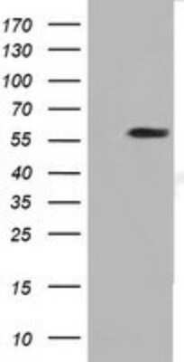 Western Blot DYNC1LI1 Antibody (OTI2E8) - Azide and BSA Free