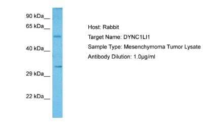 Western Blot: DYNC1LI1 Antibody [NBP2-87316] - Host: Rabbit. Target Name: DYNC1LI1. Sample Tissue: Human Mesenchymoma Tumor lysates. Antibody Dilution: 1ug/ml