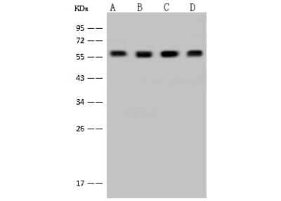 Western Blot: DYNC1LI1 Antibody [NBP2-97545] - Anti-DYNC1LI1 rabbit polyclonal antibody at 1:500 dilution. Lane A: K562 Whole Cell Lysate. Lane B: HeLa Whole Cell Lysate. Lane C: Jurkat Whole Cell Lysate. Lane D: 293T Whole Cell Lysate. Lysates/proteins at 30 ug per lane. Secondary Goat Anti-Rabbit IgG (H+L)/HRP at 1/10000 dilution. Developed using the ECL technique. Performed under reducing conditions. Predicted band size: 57 kDa. Observed band size: 57 kDa